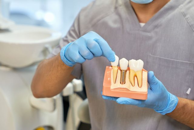 The Complete Guide to Dental Implants: Hawthorn’s Ultimate Solution